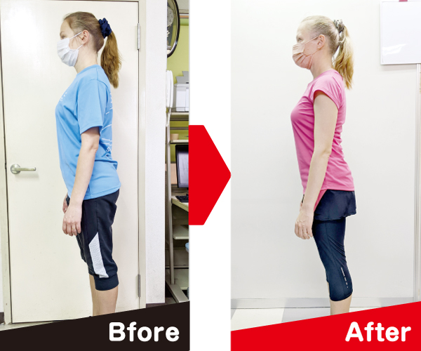 before-after2-600-500